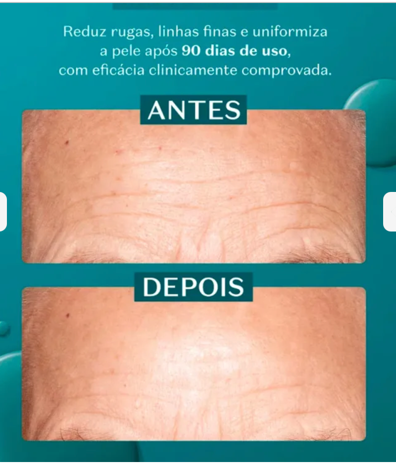 Siero ad Alta Potenza Acido Glicólico Botik, 30ml